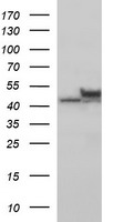 TUBB2B Antibody