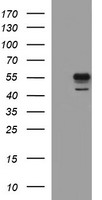 MMP13 Antibody