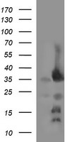 EPCAM Antibody