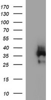 EPCAM Antibody