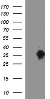 EPCAM Antibody