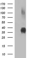 EPCAM Antibody
