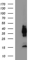 EPCAM Antibody