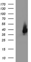 EPCAM Antibody