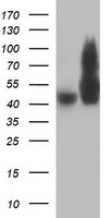 TUBB2B Antibody