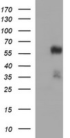 TUBA1B Antibody