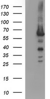 Tyrosine Hydroxylase Antibody