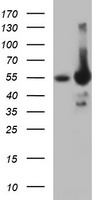 Tyrosine Hydroxylase Antibody