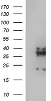 Synaptophysin Antibody