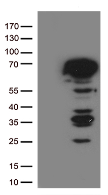 ESR1 Antibody