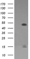 FCGR1A Antibody