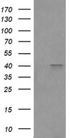 FCGR1A Antibody