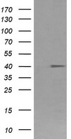 FCGR1A Antibody