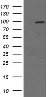 CD56 Antibody