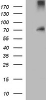 CD105 Antibody