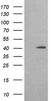 ACAA2 Antibody