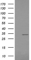 RARRES1 Antibody