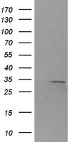 RARRES1 Antibody