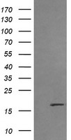 NY-ESO-1 Antibody