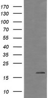 CTAG1B Antibody
