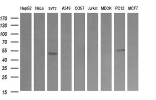 TRIM38 Antibody