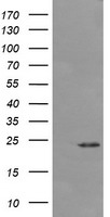 DPCD Antibody
