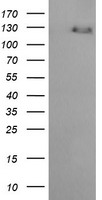 Her2 Antibody
