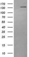 Her2 Antibody