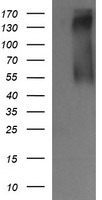 Her2 Antibody