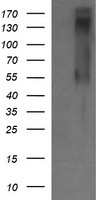 Her2 Antibody