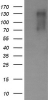 Her2 Antibody