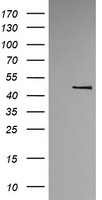 TRMT1 Antibody