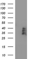 CD272 Antibody