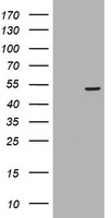 Tapasin Related Protein Antibody