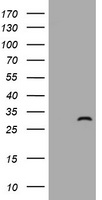 ZFYVE21 Antibody