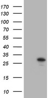 TRAPPC4 Antibody