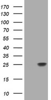 RHOJ Antibody