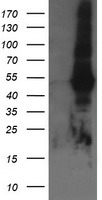 TAPBPL Antibody