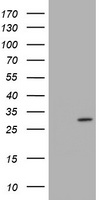 TRAPPC4 Antibody