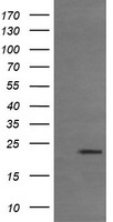 RHOJ Antibody
