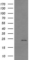 RHOJ Antibody