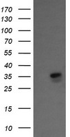 KIF25 Antibody