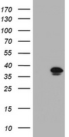 KIF25 Antibody