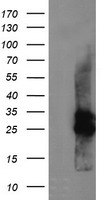 CMPK1 Antibody
