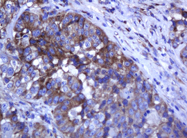 ARMC1 Antibody