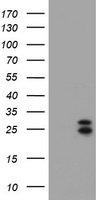 CMPK1 Antibody