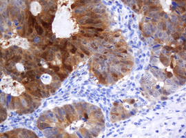 CMPK1 Antibody