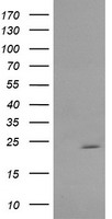 RAB30 Antibody