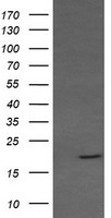 RAB30 Antibody