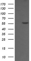 CESK1 Antibody